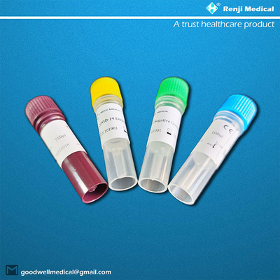 Renji Rt Pcr Test Home-Uitrustings voorafgaande neus/oropharyngeal Steekproef