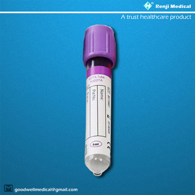 De Inzamelingsbuizen van het EDTA Beschikbare VacuümdieBloed in Hematologie 5ml 6ml worden gebruikt