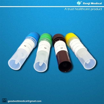 Rechts-PCR Nucleic Zuur die in real time Kit With Sputum Specimens testen